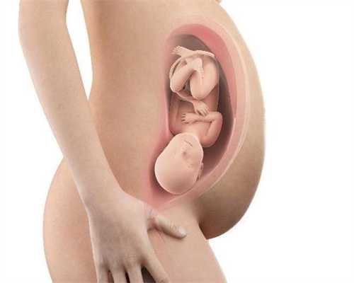 ：孕期中的白癜风准妈妈们