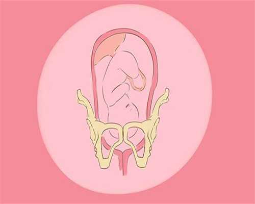 烟台包成功助孕产子网：孕期准妈妈关节疼痛怎么办？