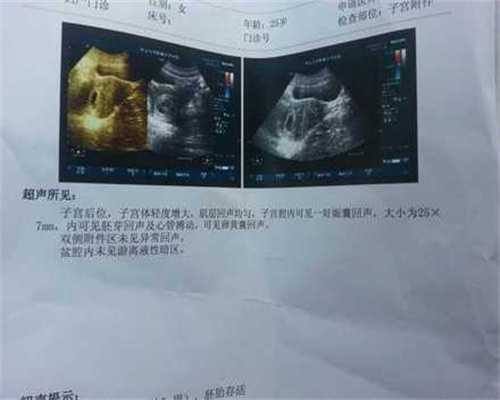 连云港包成功助孕公司gj：孕期可以根据什么症状来判断