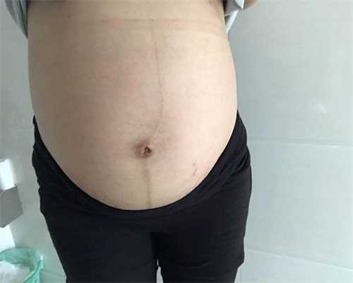扬州包成功助孕生子：怀孕6个月孕妇，孕检发现胎儿畸