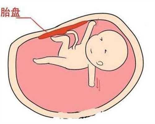 周口包成功助孕QQ群：怀孕两个月 孕妈苦痛难诉说