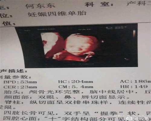 杭州有人愿意做代孕妈妈吗,卵巢癌临死都很惨